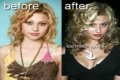 Aly Michalka Plastic Surgery Before and After