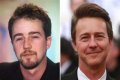 Edward Norton Plastic Surgery Before and After