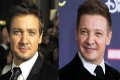 Jeremy Renner Plastic Surgery Before and After 