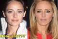 Kim Raver Plastic Surgery Before and After